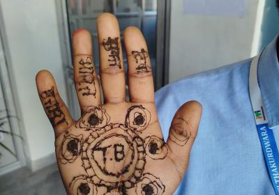 17